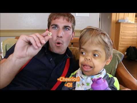 The Miracle Mann (Thanatophoric Dysplasia Dwarfism)