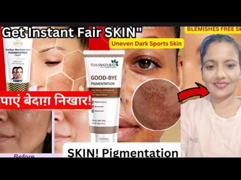 7 days natural good bye pigmentation cream review ll best cream for freckles ll pigmentation cream