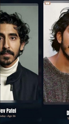 Dev Patel — Slumdog Millionaire to Director | Then & Now (2026)