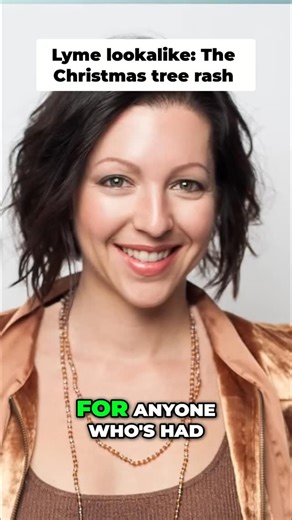 🍃Pityriasis Rosea - What Is It & How To Deal With It. 🍃What exactly is pityriasis rosea? 🍃Is it contagious? 🍃What could help the condition? 🍃What is chickweed and how can it help with itchy skin? Full episode 🔗 https://youtu.be/DXPZDgKBUF4?si=cw43Hbf3yeh6wQK9 @jenniferfugo #pityriasisrosea #skinconditions #immunehealth #chroniclyme #skinhealth | Darin Ingels, ND, FAAEM