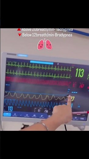 🫀 Cardiac Monitor Readings Explained in 60 Seconds! ⚡📟 #nursing