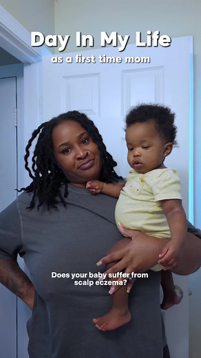 Does your baby suffer from scalp eczema? 😩🍼 @Reagan Sanai #EczemaRelief #EczemaSolutions #Eczemacare #Scalpcareforkids #washday