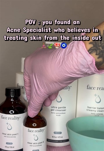 at Soluneé Spa we treat acne at the root source not just the symptoms! If ready to start your clear skin journey join my acne Bootcamp program today! Westminster, CO 📍 Link in bio! ✨ #denveresthetician #denveracnespecialist #denverfacial #westminsterfacial #westminsterspa