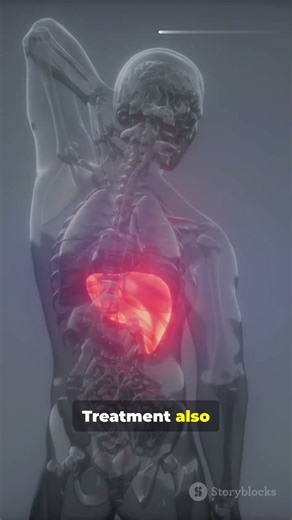 Plasmodium ovale !! the parasite hides for months !#malaria #plasmodiumovale#shorts #sciencefacts