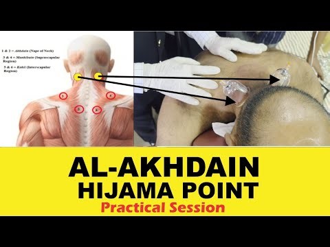 Al Akhdain Hijama Point – PRACTICAL SESSION