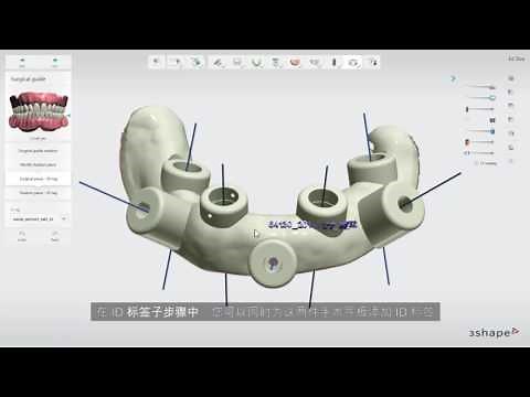 3Shape Implant Studio -无牙颌病例- 5. 如何设计手术导板