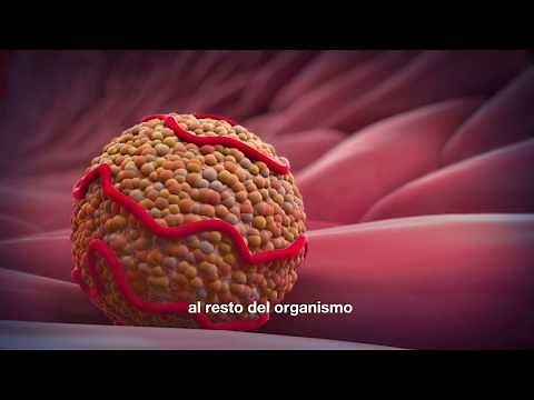 ¿Cómo se forma la placa de ateroma?