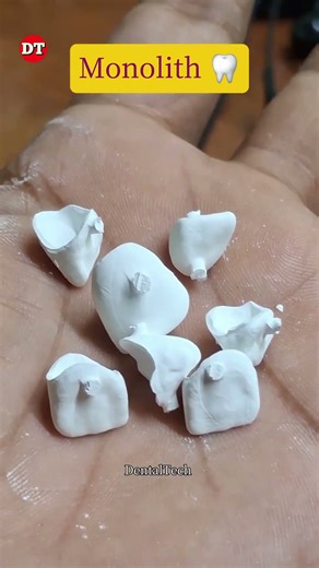 Monolith Crown 🦷|| Dental technician video| Zirconia design| Exocad| laboratory| anterior| posterior