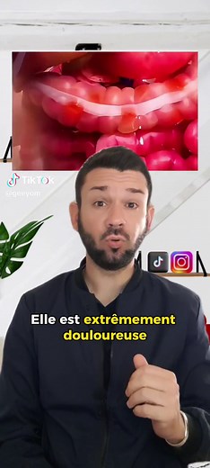 Maladie de Crohn : Comprendre les symptômes et traitements