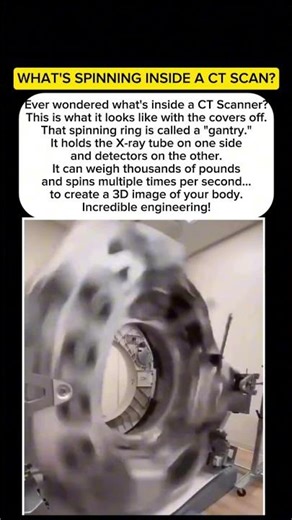 This is What's Spinning Inside a CT Scanner #shorts #viral #scanner