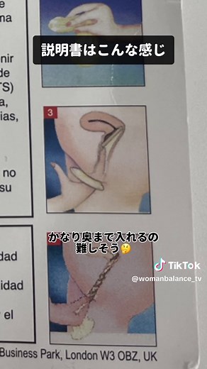 女性用コンドームの正しい使い方と効果