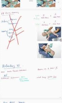 AHA BLS ACLS UPDATE 2025 #acls #aha #update #criticalcare