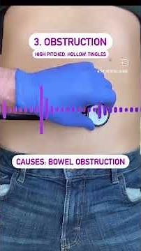 Bowel Sounds | Abnormal bowel Sounds | Hyperactive|Hypoactive Bowel Sounds| #nclex #neet #aiims