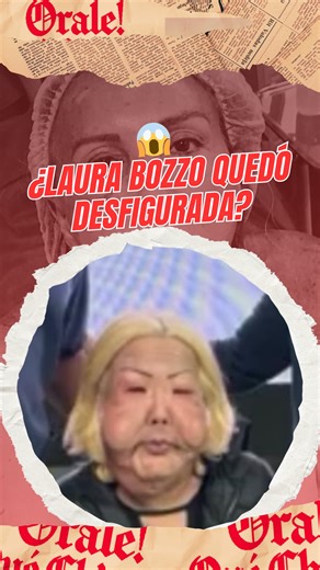 📸 Una imagen, miles de rumores… Laura Bozzo aclara la foto viral que aseguraba que estaba “desfigurada”. ¿Fake news o morbo digital? 👀🔥 #LauraBozzo #FakeNews #Espectáculos #Viral #Polémica | Órale Qué Chiquito