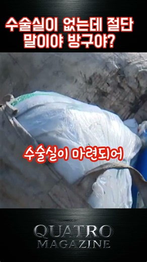 수술실이 없는데 다리절단을 했다고??
