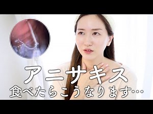 【地獄】アニサキスに寄生されたけど質問ある？【胃カメラ】