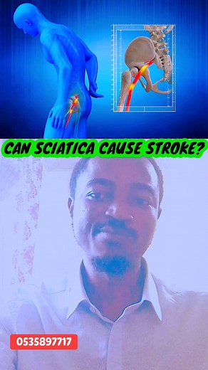 13K views · 351 reactions | This is what you should about sciatica and stroke. Know the difference between them #stroke #sciatica #nervepain #healthy #lifestyle #sciaticapain #tips #fblifestyle | Enock Appiah | Facebook