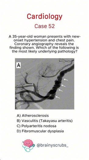Cardiology - Case 52