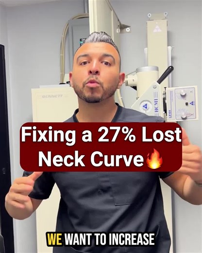 27% loss of the neck curve👉here’s how we increase it✅ Strategic support, stabilizing straps, and a forward forehead pull to guide the spine back into alignment. 🎥 Watch the full video for the full breakdown and explanation. #CervicalCurve #PostureCorrection #SpinalAlignment #ChiropracticCare #StructuralCorrection #NeckPainRelief #SpineHealth #CorrectiveCare #Biomechanics #PostureMatters #WatchFullVideo