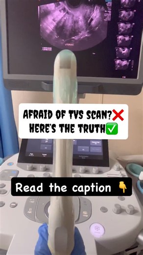 6.6K views · 787 reactions | Here’s the Real Truth About a TVS...