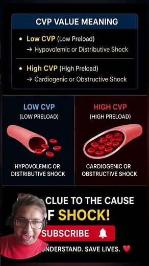 High-Yield USMLE: CVP in Hypovolemic, Cardiogenic & Obstructive Shock