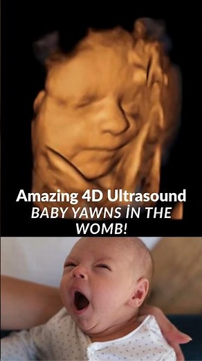 Amazing 4D Ultrasound: 30 Weeks Baby Yawns in the Womb!