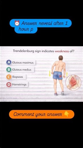 📚 Orthopedics MCQTrendelenburg sign indicates weakness of?#neetpg #inicet #medicalmcq #orthopedics