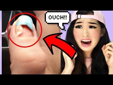 Try Not To Cringe At These Photos!!