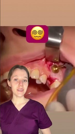Sinus lift procedure