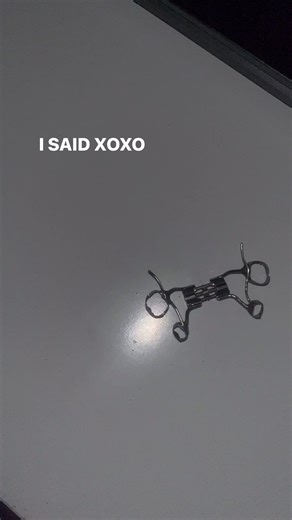 #braces #palateexpander #teeth #trauma #dentist Hate that palate expander had it in 2022 or smth like that