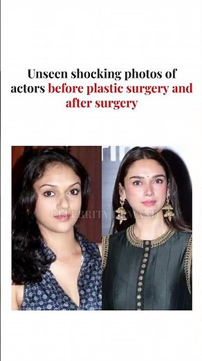 Deepika & Janhvi Kapoor PLASTIC SURGERY Before/After SHOCKING Photos😱 #DeepikaPadukone #JanhviKapoor
