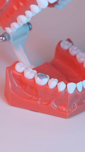 1.4M views · 3.4K reactions | Take care of your teeth! | 5-Minute Crafts Men | Facebook