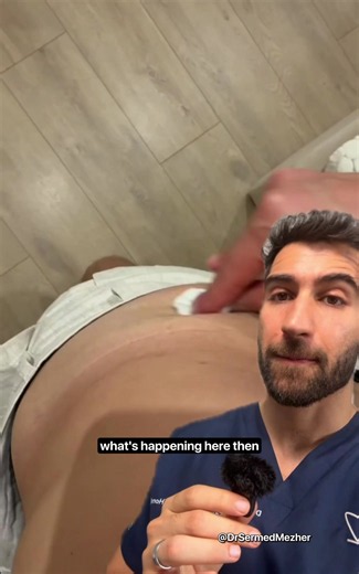 POV: You Get an Injection Gun. Sources- PMID 31587143 urolog_tiktoka on TT An intramuscular (IM) injection deposits medication deep into muscle tissue, which is highly vascular and capable of accommodating larger fluid volumes (typically up to three to five milliliters in larger muscles) compared to subcutaneous (SubQ) tissues. Despite the rich blood supply, the absorption rate of IM injections can actually be adjusted to be slower and more sustained than SubQ injections by using specific depot 