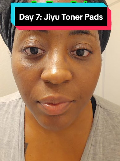 Here is the one week update. In 7 days my hyperpigmentation has been reduced and my youthful skin is glowing. #jiyutonerpads #jiyu #koreanskincareproducts #hyperpigmentation #skincarereview