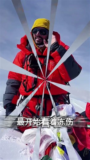 How serious is third-degree frostbite? #EncyclopediaCode #SciencePopularization #LearnMore