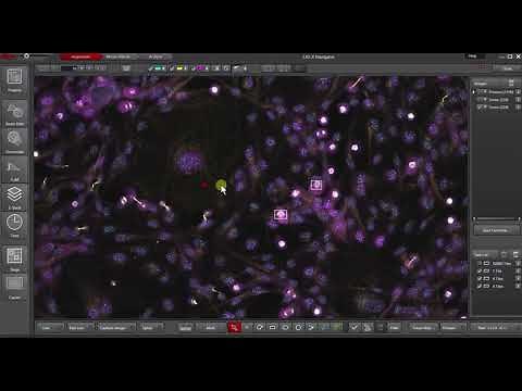 From the big picture to super-resolution detail: LAS X Navigator meets TauSTED