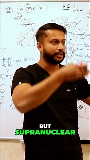 Scanning Speech: Understanding Cranial Nerves and Brain Stem Issues #shorts