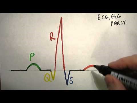 EKG, PQRST