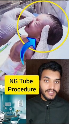 NG Tube insertion procedure
