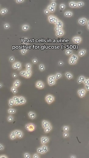 Urine microscopy 🤩 #lablife #medicallaboratoryscience | Lab life