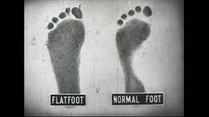 CIRCA 1930s - Close-ups show how fallen arches lead to flat feet, and a man with healthy feet is seen on a boat and climbing in nature.