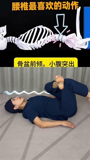 Fix Pelvic Tilt & Lower Back Pain - Easy Home Exercises