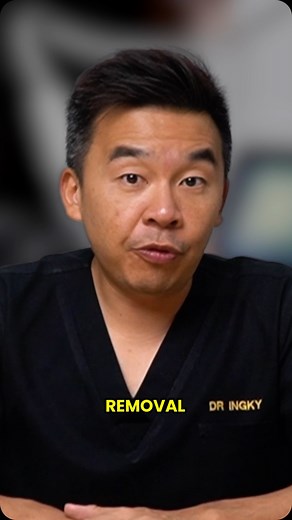 👉🏻Is tattoo removal painful? How many sessions required for complete removal? 🔸Let’s see how tattoo works in the first place. Tattoo is a permanent body art created by injecting ink into the dermis layer. In Medii Skin, we use Q-Switch laser for black and brown tattoo. 🔸Q-switched lasers emit high-energy pulses in nanoseconds, targeting tattoo pigments. 🔸Multiple sessions of Q-Switch laser will gradually fade the tattoo while minimizing damage to surrounding tissue. P/S: One thing about tat