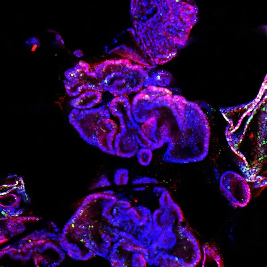 Can 'mini brains' replace lab animals? Organoids are changing how scientists study disease