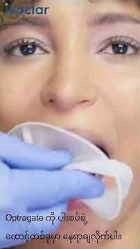 Ivoclar- Instruction of Optragate lip-cheek-retractor (Burmese)