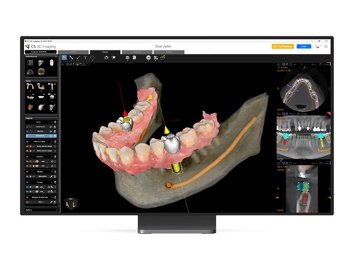 CS imaging premium - 360 Visualise