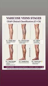 varicose veins stages CEAP clinical classification (C1-C6)