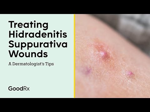 Treating Hidradenitis Suppurativa Wounds: A Dermatologist’s Tips | GoodRx