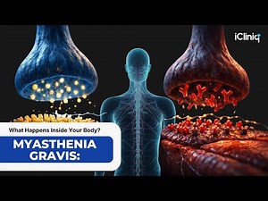Myasthenia Gravis: What Really Happens Inside Your Body?