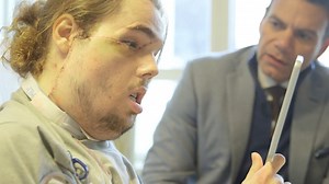 Before and after video of a face transplant patient